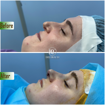 Slider image (5) Dr. Ho Co - Aesthetics and Plastic Surgery in Vietnam